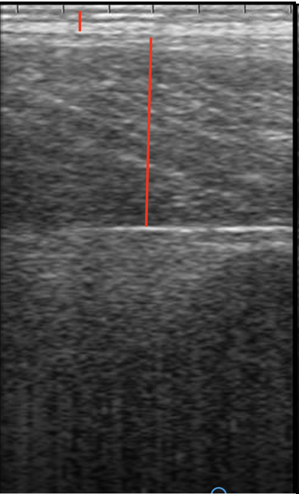 Ultrasound image showing back fat and muscle depth at Day -28 relative to expected calving